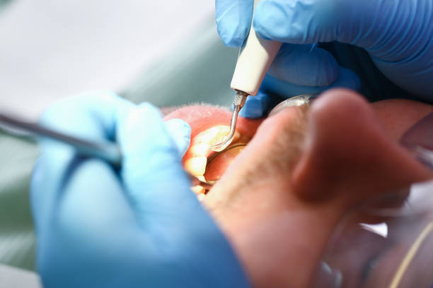 Best Urgent Dental Care for Toothaches in Rendon, TX